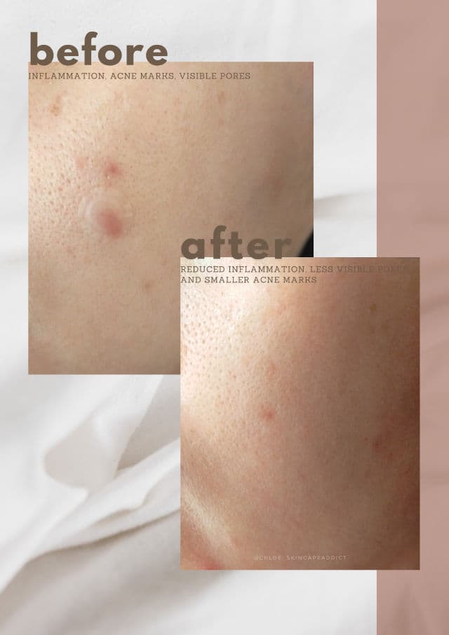 Dr. Douxi Egg Shell Revital & Lifting Veil review photo by chloemont