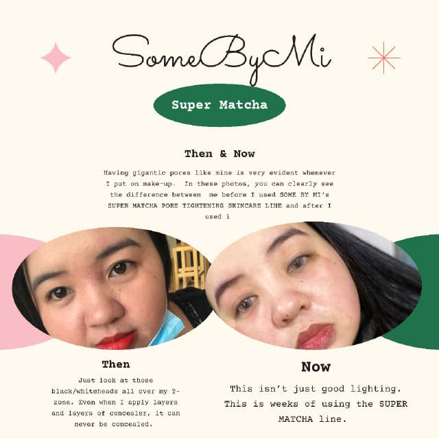 Some By Mi Super Matcha Pore Tightening Toner review photo by chweetsays