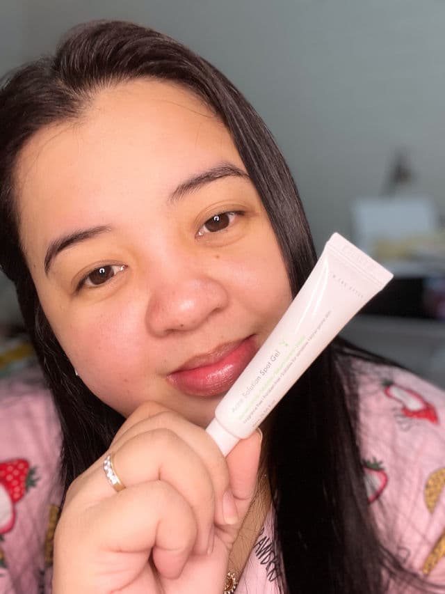 Now and After Acne Solution Spot Gel review photo by chweetsays