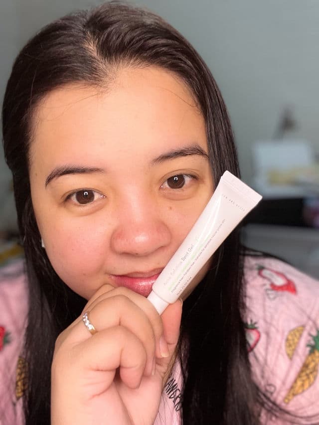 Now and After Acne Solution Spot Gel review photo by chweetsays