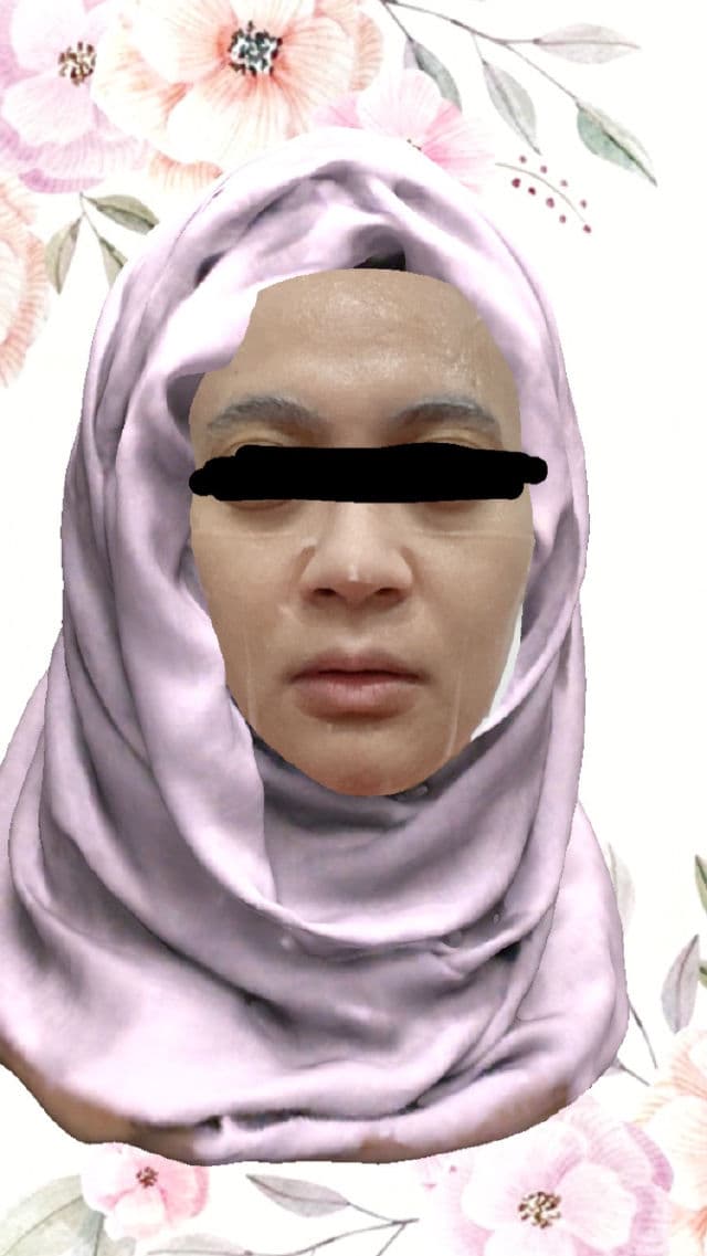 Some By Mi Hyaluron Moisturizing Glow Luminous Ampoule Mask review photo by cikbskincarestories