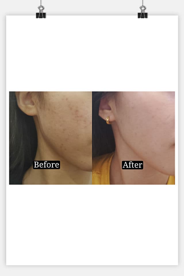 SKIN1004 Madagascar Centella Ampoule review photo by cn24