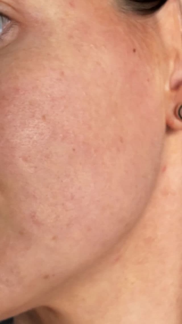 Pestlo The Seed Real Collagen Mask review photo by cuquix