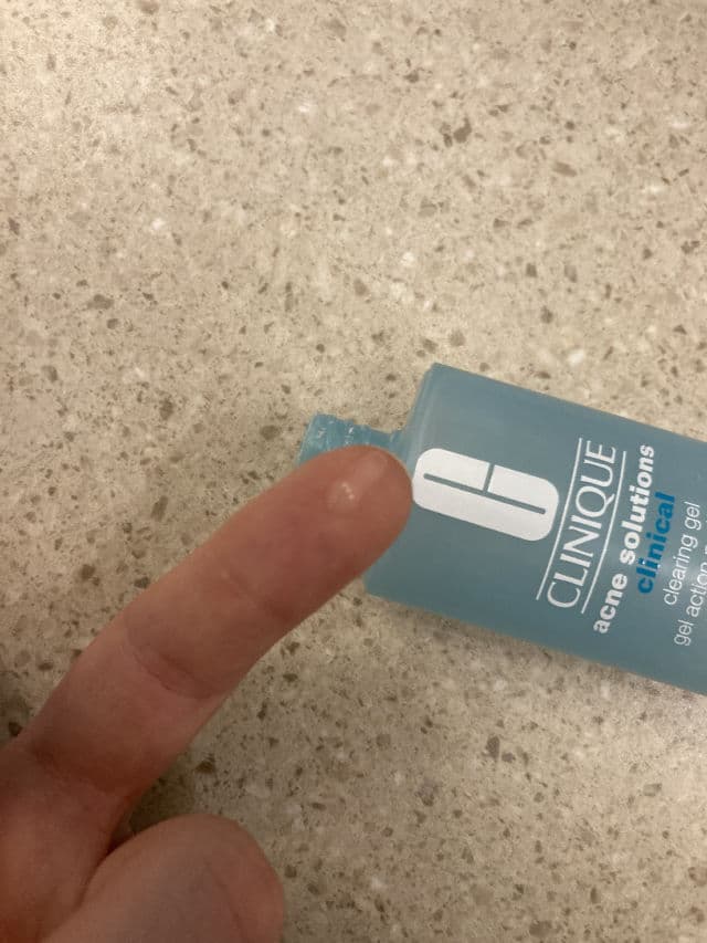 Clinique Acne Solutions Clinical Clearing Gel review photo by curlyemily