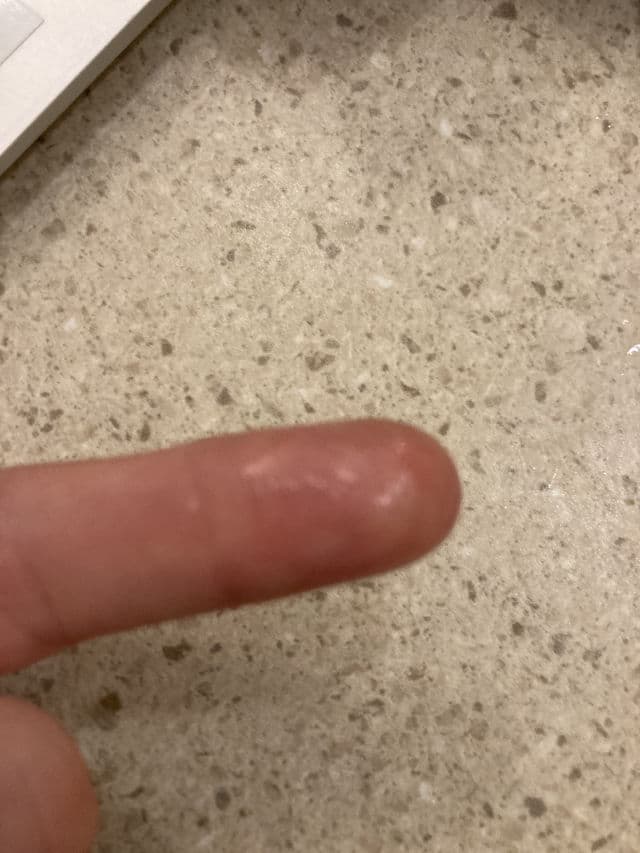 Thursday Plantation Tea Tree Oil review photo by curlyemily