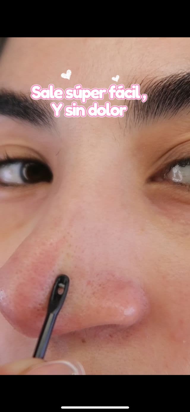 Jumiso Blackhead Melting Softener review photo by laudoramas 