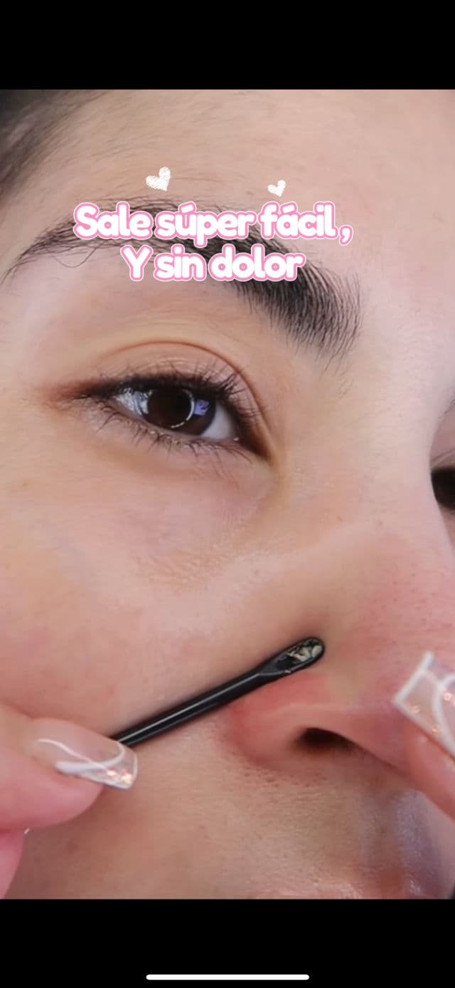 Jumiso Blackhead Melting Softener review photo by laudoramas 