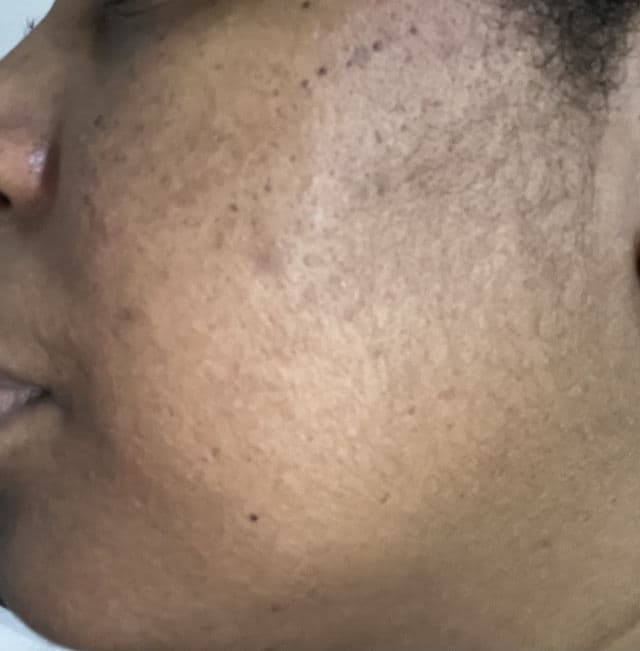 Genabelle PDRN Rejuvenating Mask review photo by mariielx