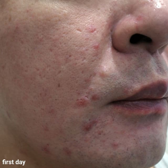 SKIN1004 Madagascar Centella Ampoule review photo by danielwonderland