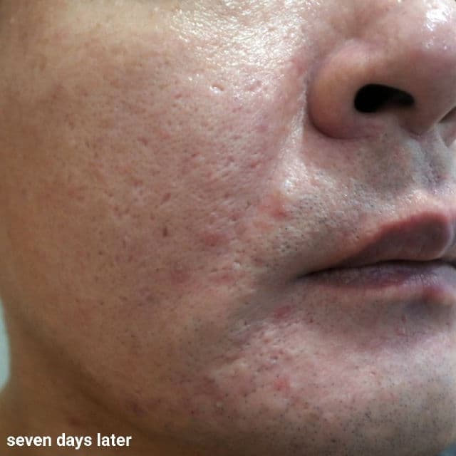 SKIN1004 Madagascar Centella Ampoule review photo by danielwonderland