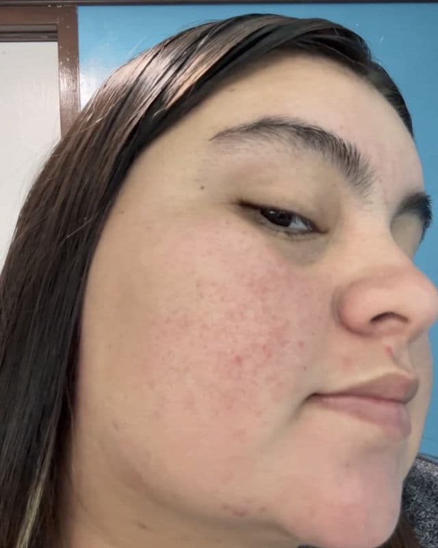 Dr.Pepti Centella Turnover Soft Peeling Gel review photo by Fernandareyes