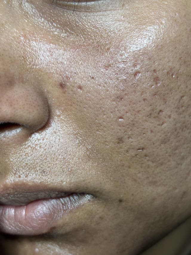 FATION Deep Barrier Soft Cleansing Foam  review photo by zoy