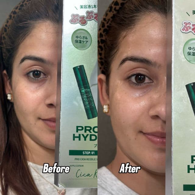 VT COSMETICS Pro Cica Reedle Shot 100 2-Step Hydrogel Mask review photo by Roshni4