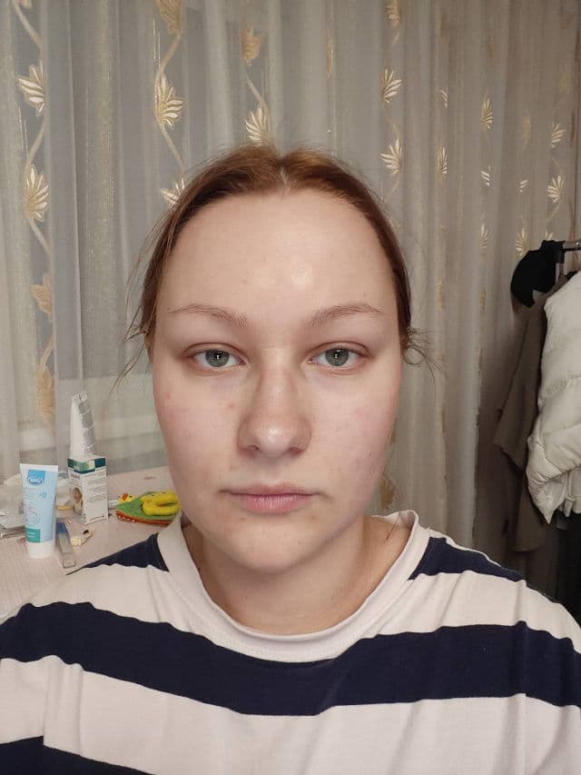 A'pieu Hamamelis Cream review photo by linmaryna