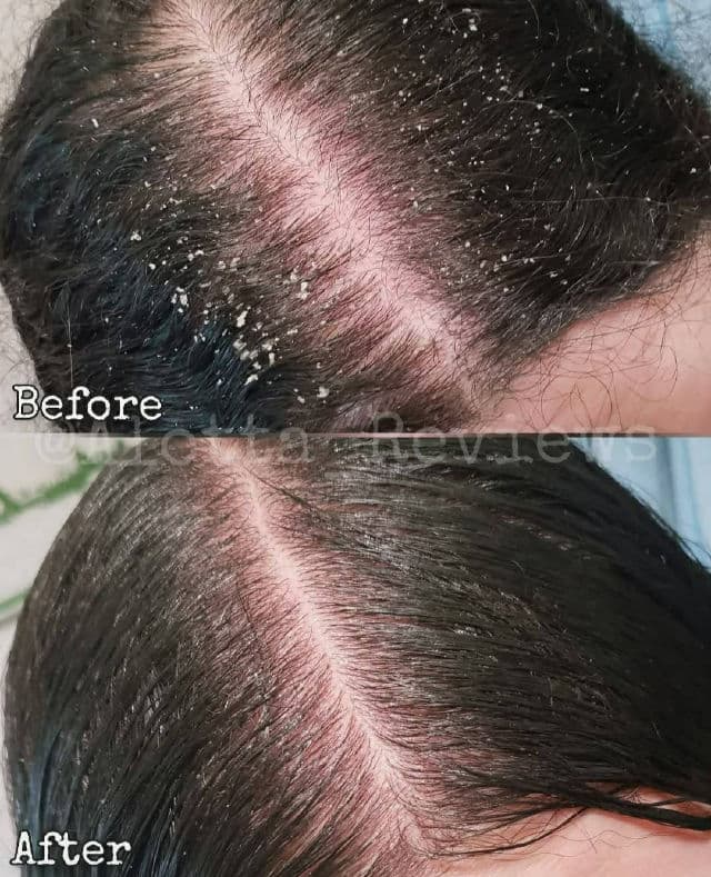 Labo-H Hair Loss Relief Scalp Strengthening Shampoo review photo by AlottaxReviews