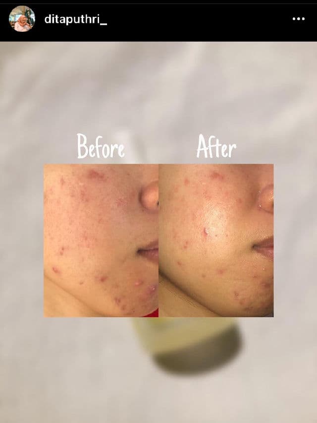 Indoganic Bakuchiol Intensive Face Oil review photo by ditaputri