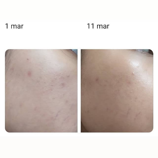 Bloomka Calendula+B3 Whitening Toner review photo by dinaotaya