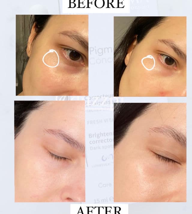 Bioderma Pigmentbio C-Concentrate review photo by duzzpi