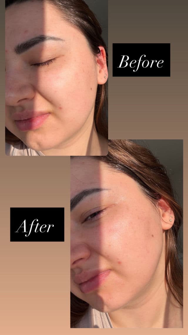 Centellian24 Madeca Cream Time Reverse Zero review photo by Rozalina49