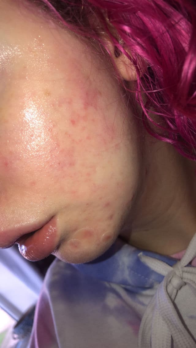 Dr. Jart+ Dr.Jart+ Ceramidin Cream Mist 110ml review photo by edgelordlucy