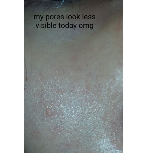 A'pieu Madecassoside Moisture Gel Cream review photo by zom