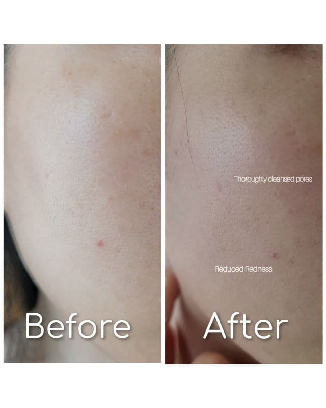 Dr. Hauschka Clarifying Clay Mask review photo by esiotrot84