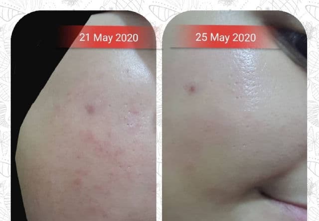 The Pastels Shop HOLO Sea Cucumber Rejuvenation First Ampoule review photo by ezatulSkincareDiary