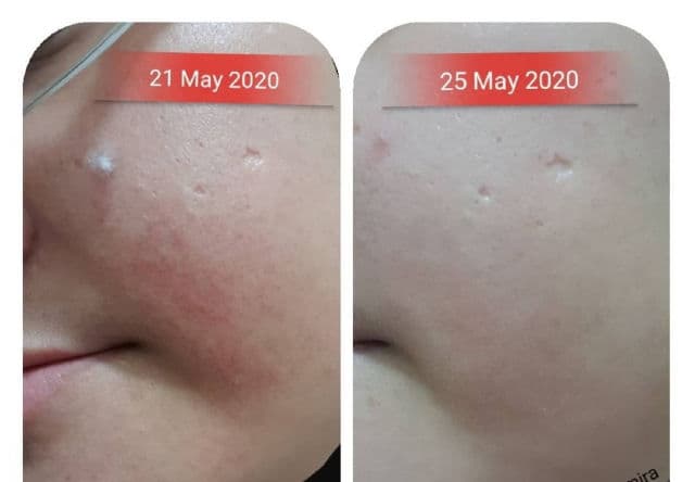 The Pastels Shop HOLO Sea Cucumber Rejuvenation First Ampoule review photo by ezatulSkincareDiary