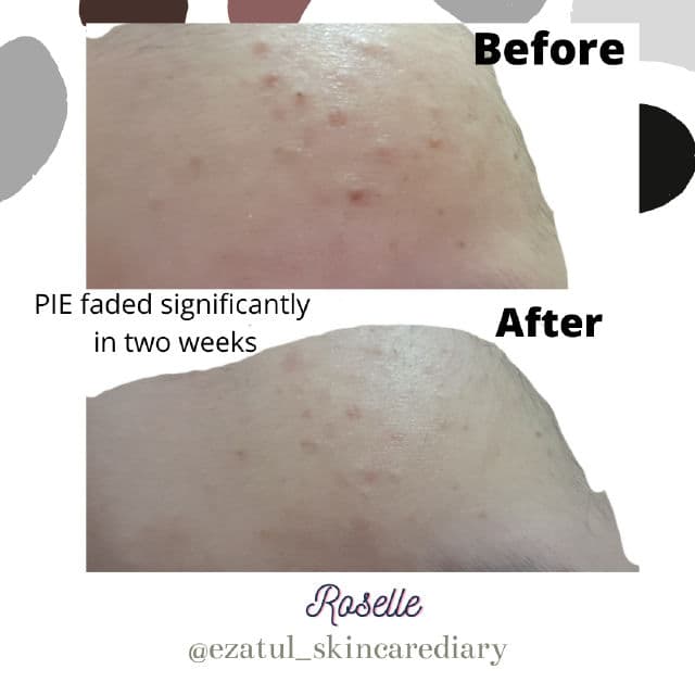 Roselle Skincare Power Essence review photo by ezatulSkincareDiary