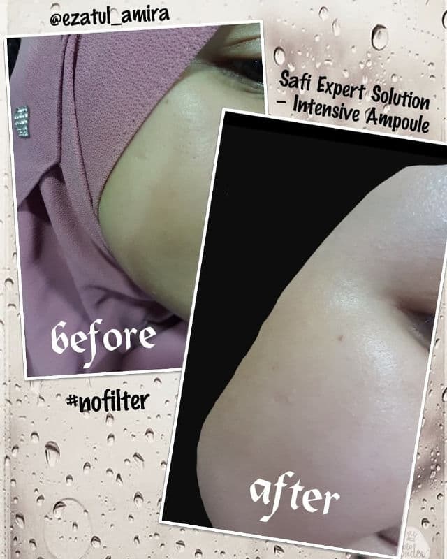 Safi Expert Solution Intensive Ampoules 2 review photo by ezatulSkincareDiary
