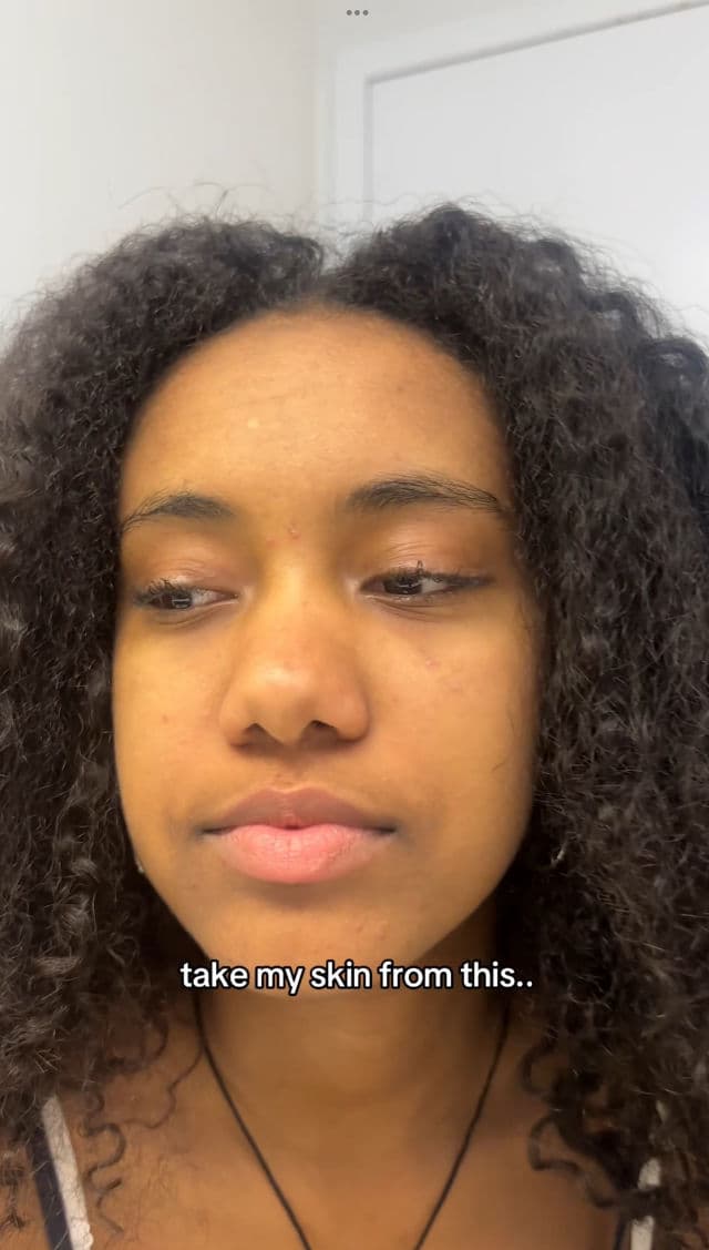 SKIN1004 Madagascar Centella Probio-Cica Enrich Cream review photo by Hiwot