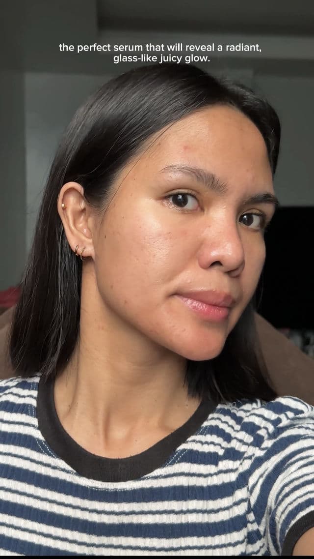 By Juccy Gooseberry Dark Spot Brightening Serum review photo by deetsandthat