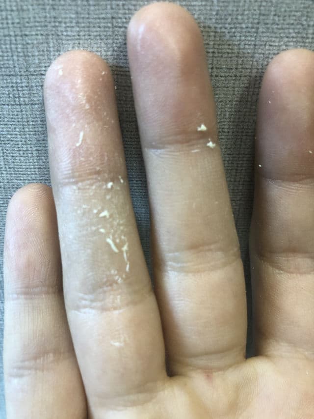 La Roche-Posay Anthelios Anti-Imperfections Gel-Cream SPF50+ review photo by fani98