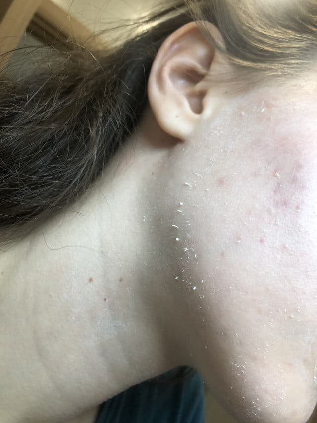 La Roche-Posay Anthelios Anti-Imperfections Gel-Cream SPF50+ review photo by fani98