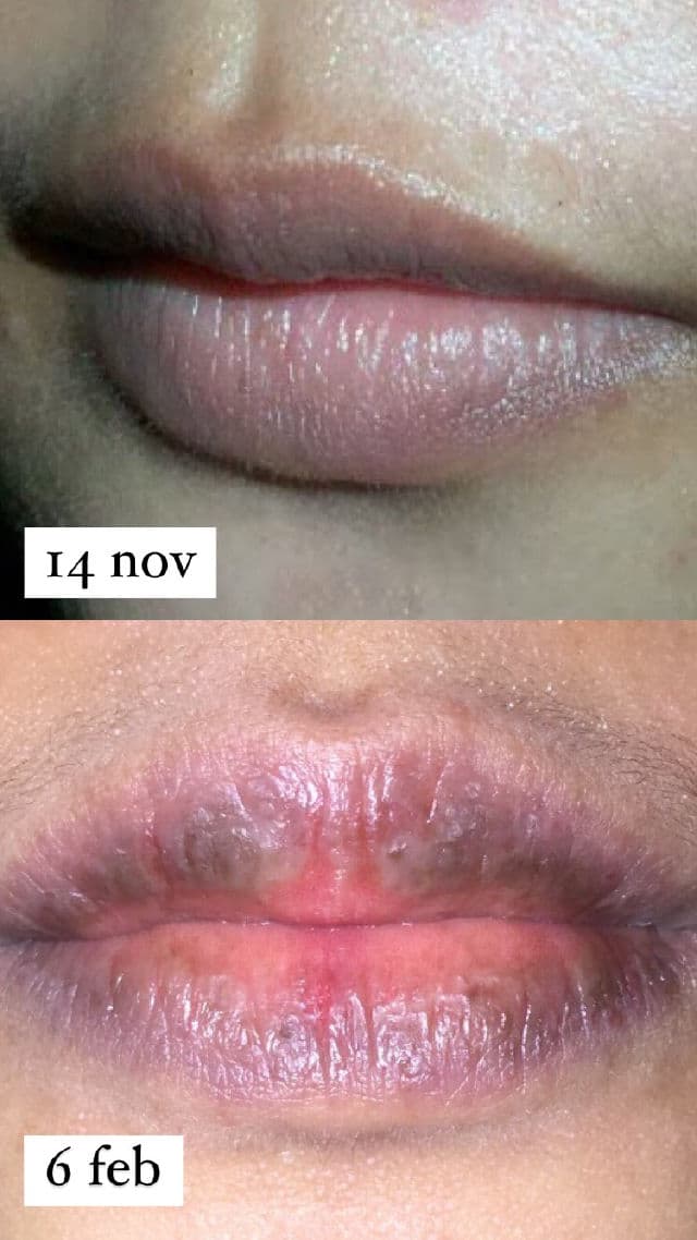 Nivea Watermelon Shine Lip Balm review photo by fatimazzz