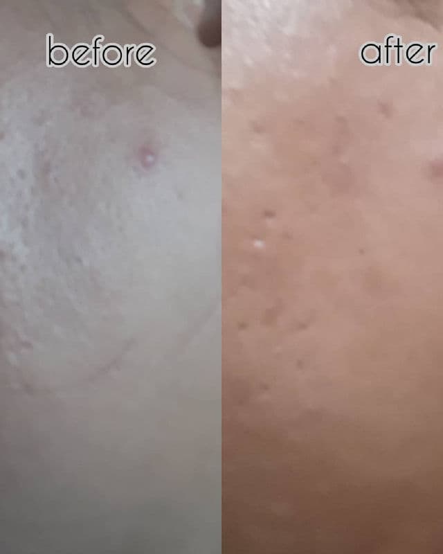 Dr. Young AC Control U-Line Clearing Mist review photo by fawziasari