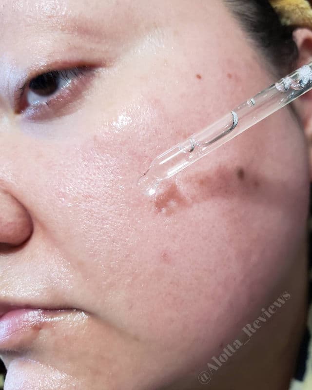 SKIN1004 Madagascar Centella Tea-Trica Relief Ampoule review photo by AlottaxReviews