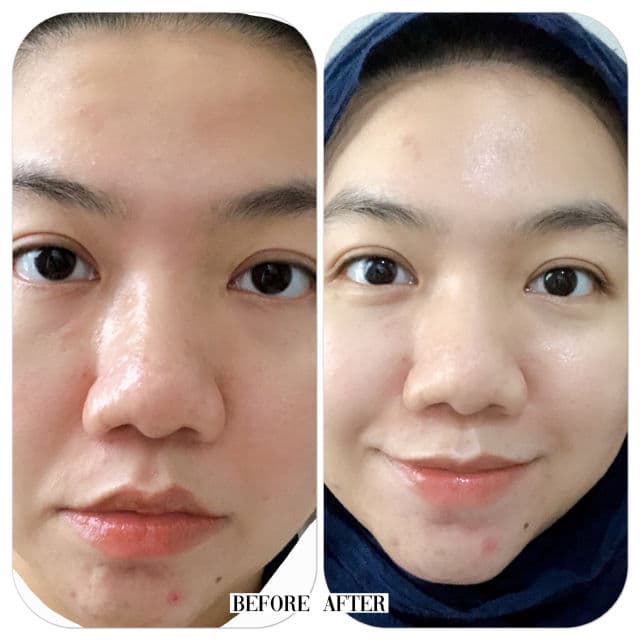 Lululun Balance Moisture Face Mask (Pink) review photo by felyfey
