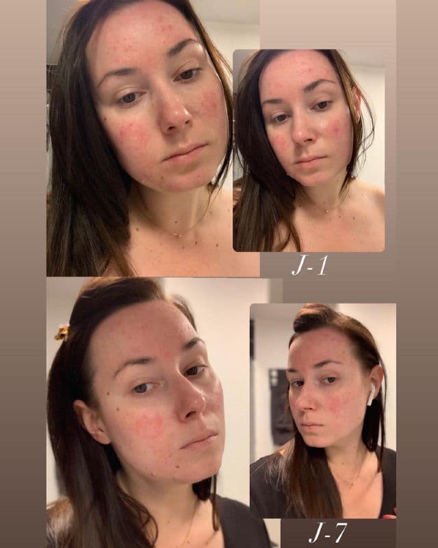 Garancia Sulfureuse Pâte du Marabout review photo by frankabeauty