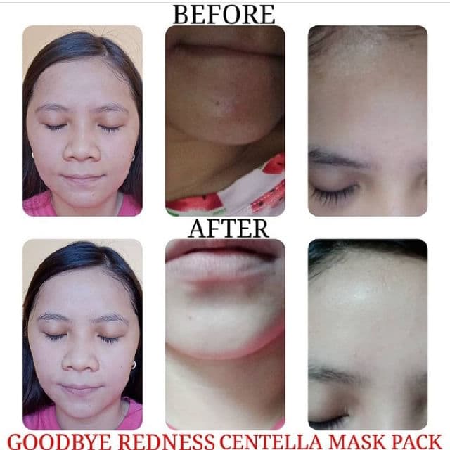 BENTON Goodbye Redness Centella Mask Pack review photo by glowriri