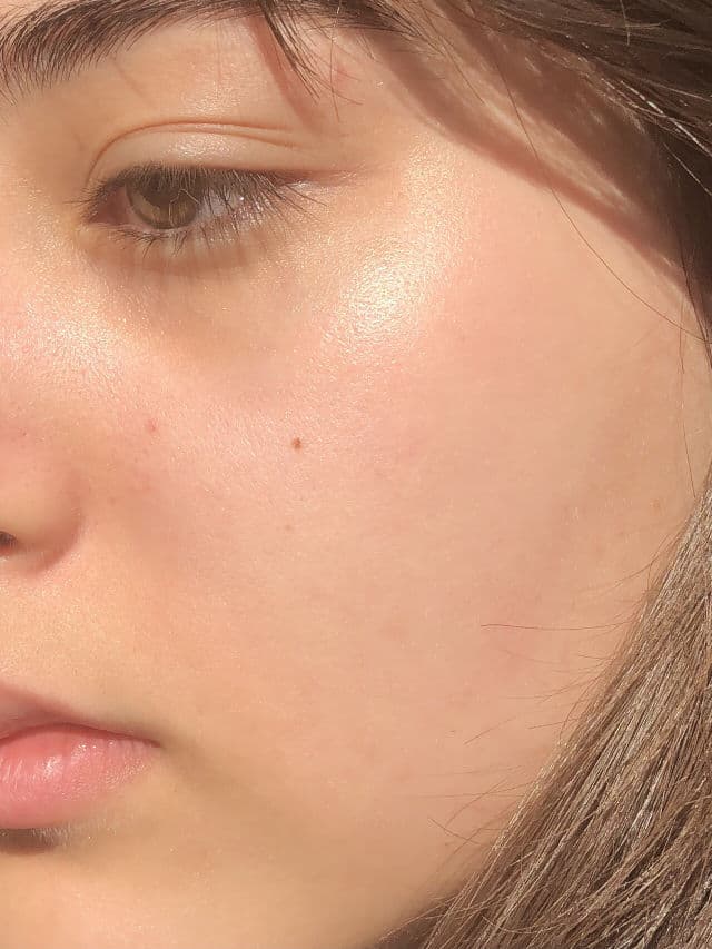 The Ordinary Niacinamide 10% + Zinc 1% review photo by hina