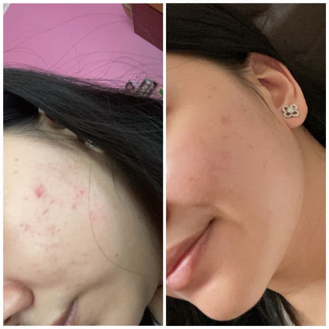 Somethinc 5% Niacinamide + Moisture Sabi Beet Serum review photo by hizkiasantoso