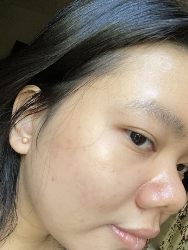 Dear Me Beauty 10% Niacinamide + Watermelon Extract Face Serum review photo by hizkiasantoso