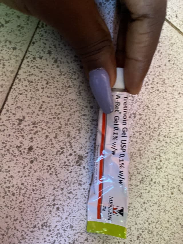 Menarini Tretinoin Gel USP A-Ret 0.1% review photo by iUzunma