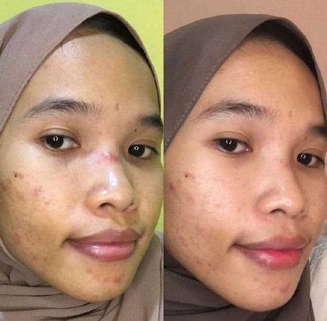 Dear Me Beauty 10% Cica + Watermelon Extract Face Serum review photo by inasbilabila