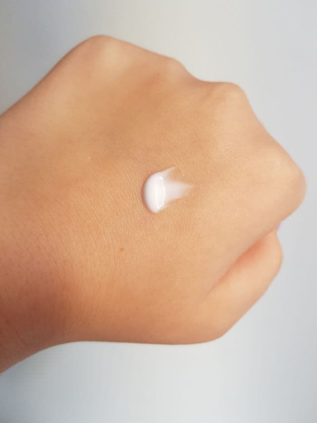 Leo Pharma Skinoren 15% Gel review photo by iuli