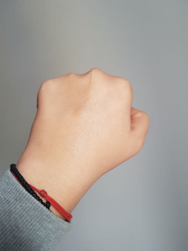 Leo Pharma Skinoren 15% Gel review photo by iuli