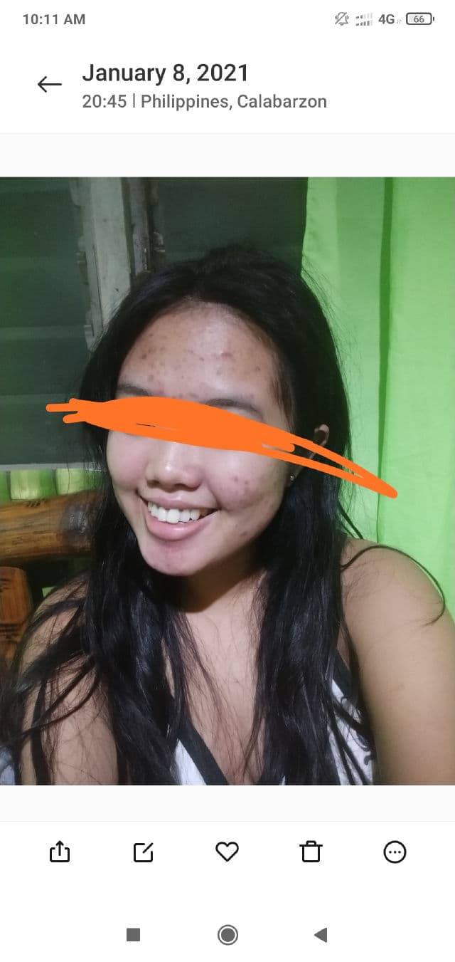 TIAM Snail & Azulene Water Essence review photo by jairahbkc