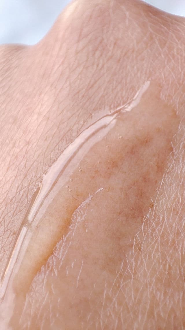 ISDIN Acniben On the Spot Gel review photo by janethw