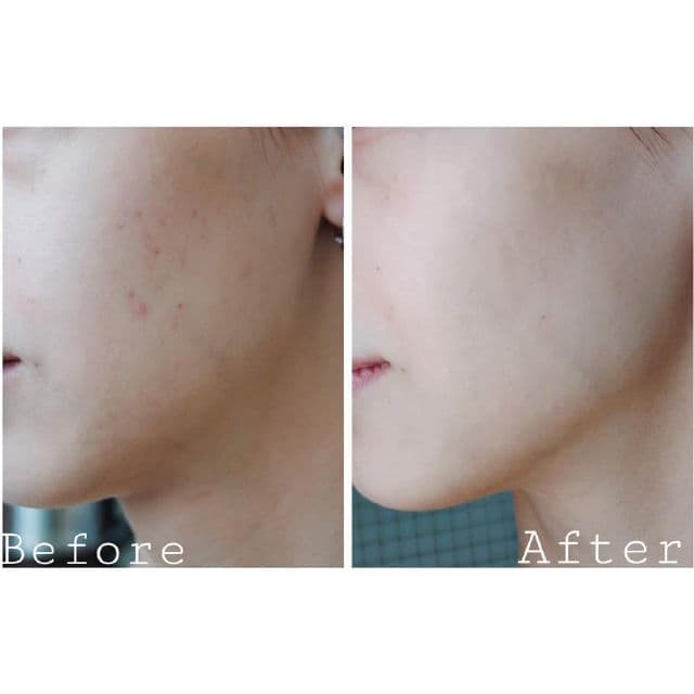 TIAM AC Fighting AHA BHA PHA Toner review photo by katefox